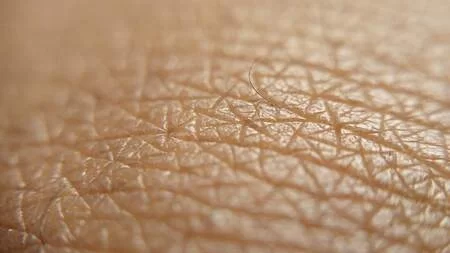An In-Depth Look at the Mohs Micrographic Surgery Recovery Process An In-Depth Look at the Mohs Micrographic Surgery Recovery Process