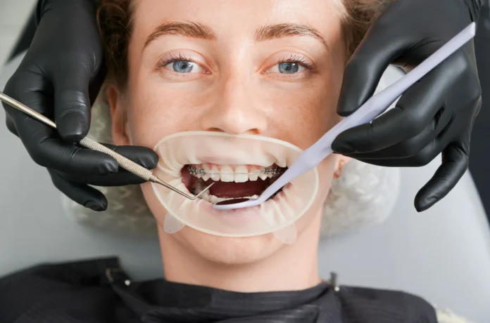 Exploring Various Treatment Options Offered by an Orthodontist Exploring Various Treatment Options Offered by an Orthodontist