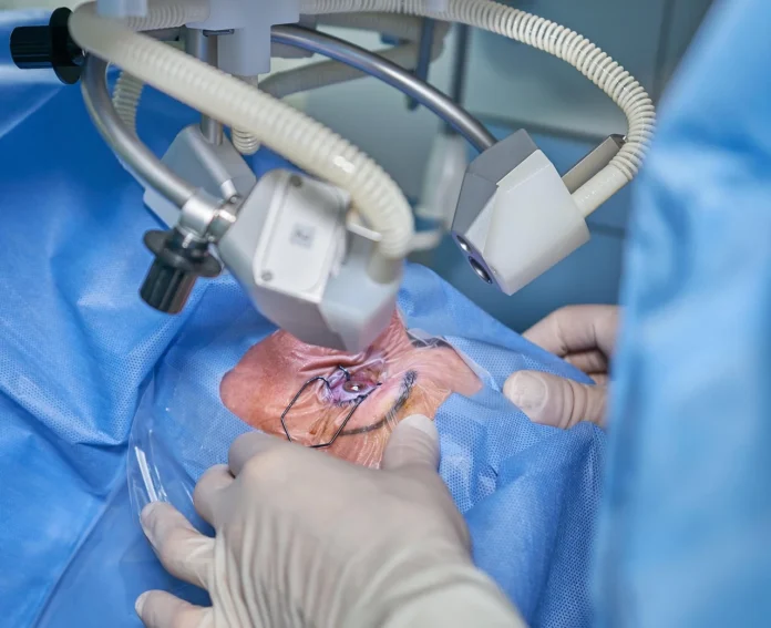 How Cataract Surgeons Choose the Right Lens for Patients How Cataract Surgeons Choose the Right Lens for Patients