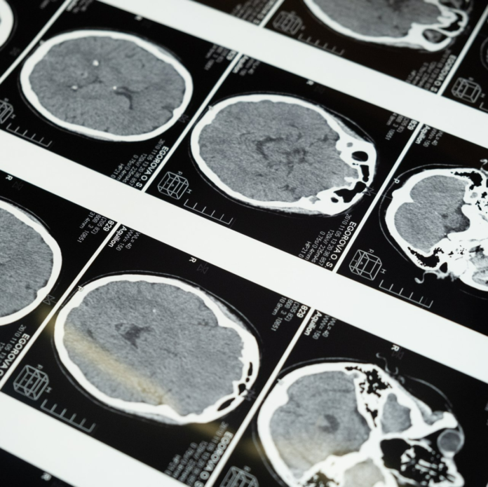 How Neurologists Use Advanced Imaging Techniques How Neurologists Use Advanced Imaging Techniques