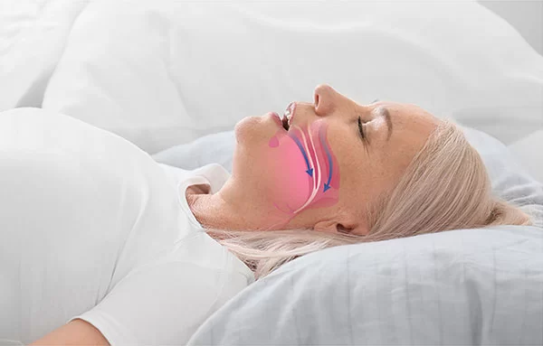 How a Pediatric ENT Addresses Sleep Problems in Children How a Pediatric ENT Addresses Sleep Problems in Children