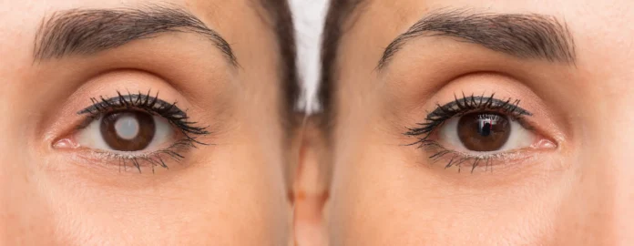 How an Ophthalmologist Can Help Manage Eyelid Issues How an Ophthalmologist Can Help Manage Eyelid Issues
