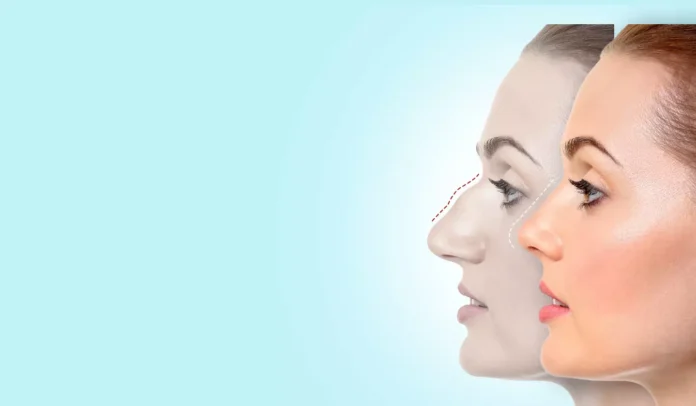 How to Make an Informed Decision About Cosmetic Surgery How to Make an Informed Decision About Cosmetic Surgery