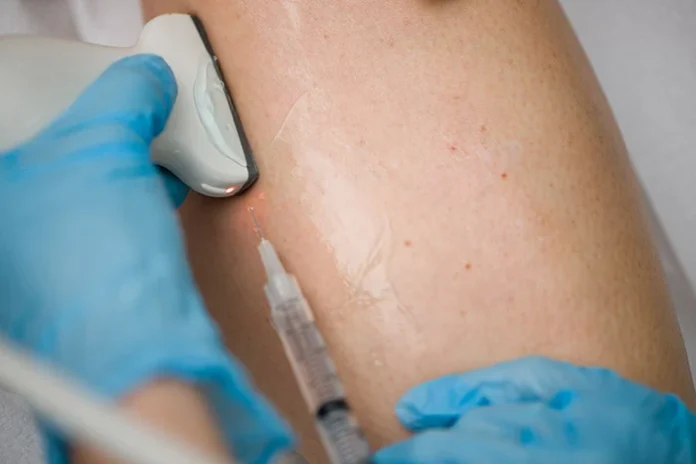 Managing Pain and Discomfort From Varicose Veins Managing Pain and Discomfort From Varicose Veins