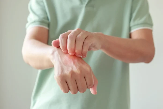 The Benefits of Allergy Testing for Effective Allergen Avoidance The Benefits of Allergy Testing for Effective Allergen Avoidance