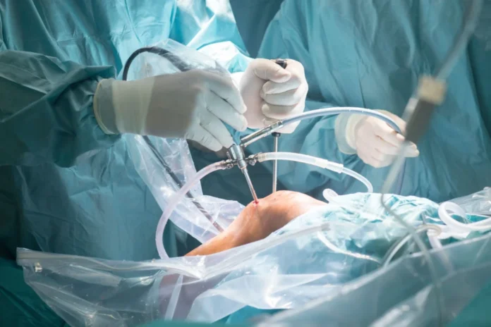 The Expertise of Orthopedic Surgeons in Joint Replacement Procedures The Expertise of Orthopedic Surgeons in Joint Replacement Procedures