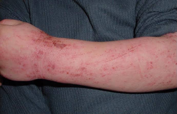 Understanding Skin Conditions Treated in Medical Dermatology Understanding Skin Conditions Treated in Medical Dermatology
