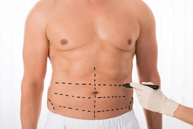 Ways To Prepare for a Tummy Tuck Ways To Prepare for a Tummy Tuck