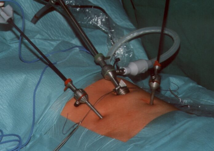 What To Know About Hernia Surgery What To Know About Hernia Surgery