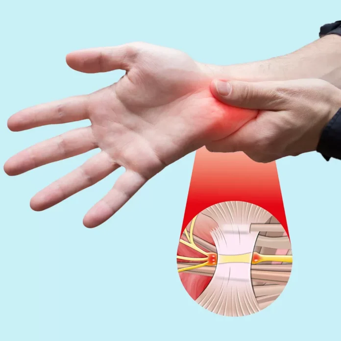 What You Need To Know About Carpal Tunnel Release Surgery What You Need To Know About Carpal Tunnel Release Surgery