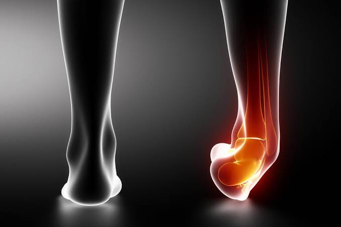 What You Need to Know About Ankle Fracture Recovery What You Need to Know About Ankle Fracture Recovery