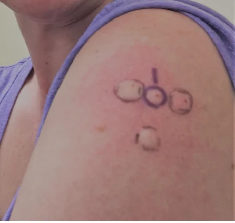 What Your Allergist Wants You to Know About Allergy Management What Your Allergist Wants You to Know About Allergy Management