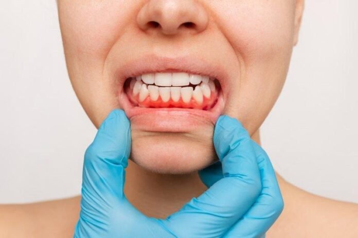 Benefits of Regular Check-ups in Preventing Periodontal Disease Benefits of Regular Check-ups in Preventing Periodontal Disease