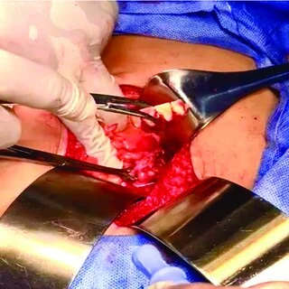How CT Scans Help Guide Surgical Decisions How CT Scans Help Guide Surgical Decisions