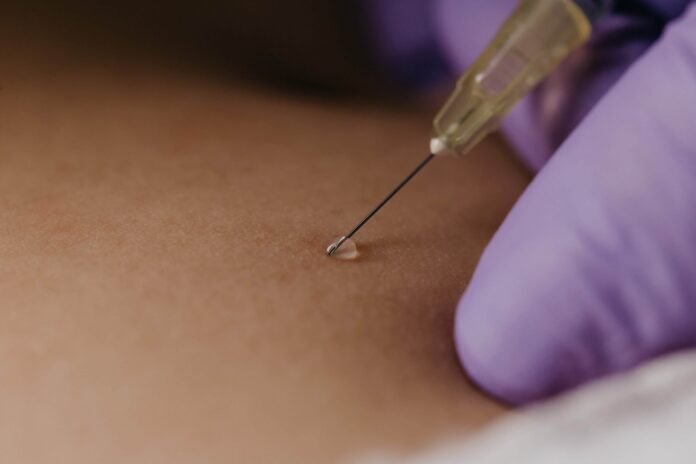 When Are Epidural Injections Recommended for Pain Relief When Are Epidural Injections Recommended for Pain Relief?